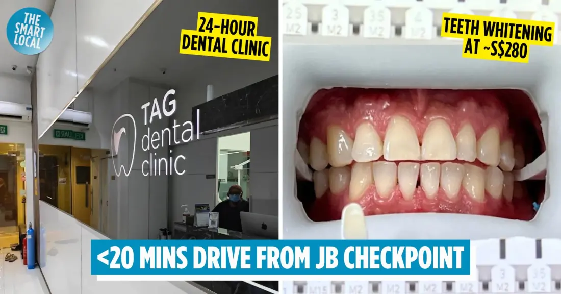 Why Singaporeans Are Crossing the Causeway for Cheap Dental Work in Johor Bahru